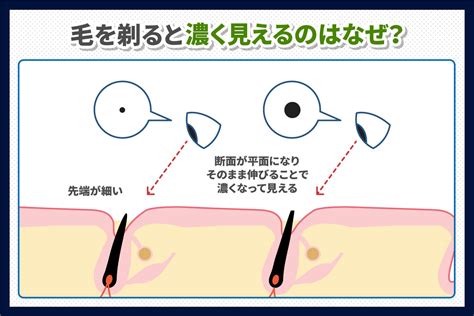 脱毛器 剃らずに|脱毛前に毛を剃っていく理由とは？剃らないで照射す。